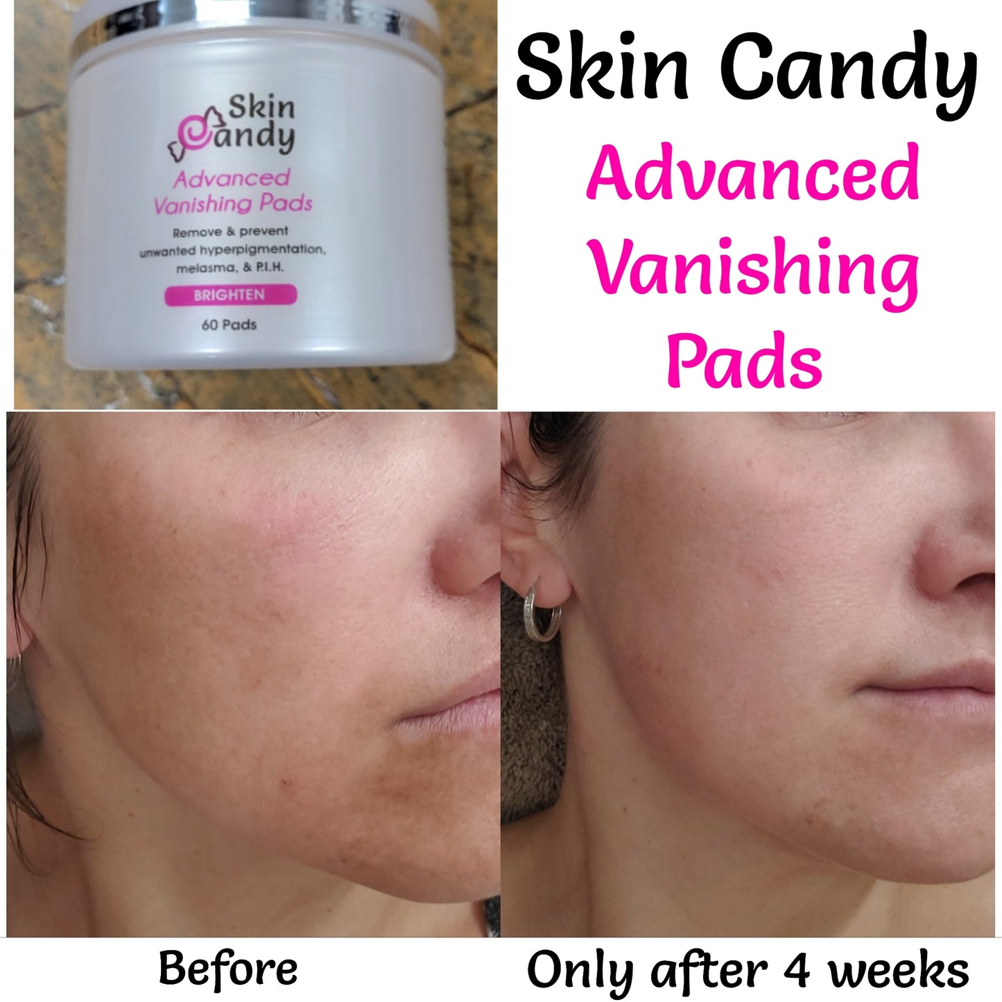 *Skin Candy Buy 3 Get 1 Free Bundle
