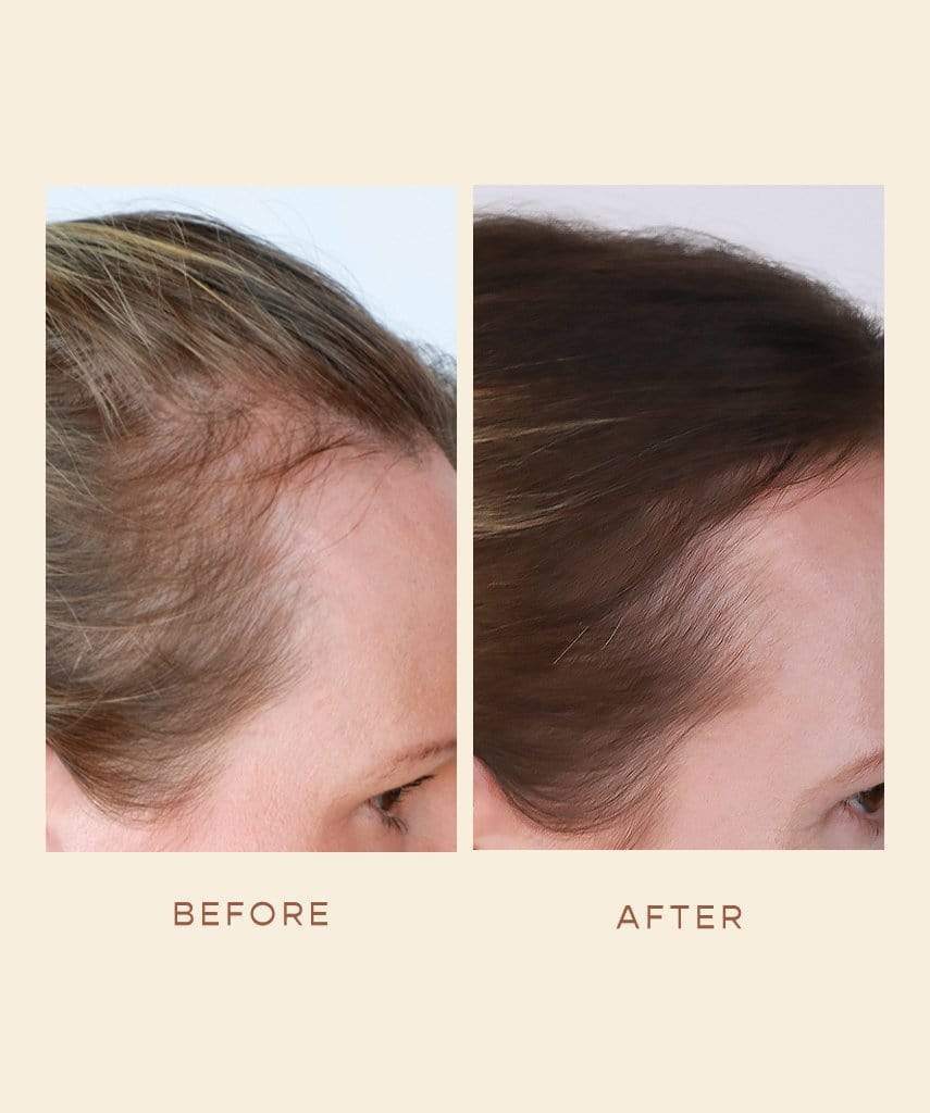 *Skin Candy Hair Growth Serum