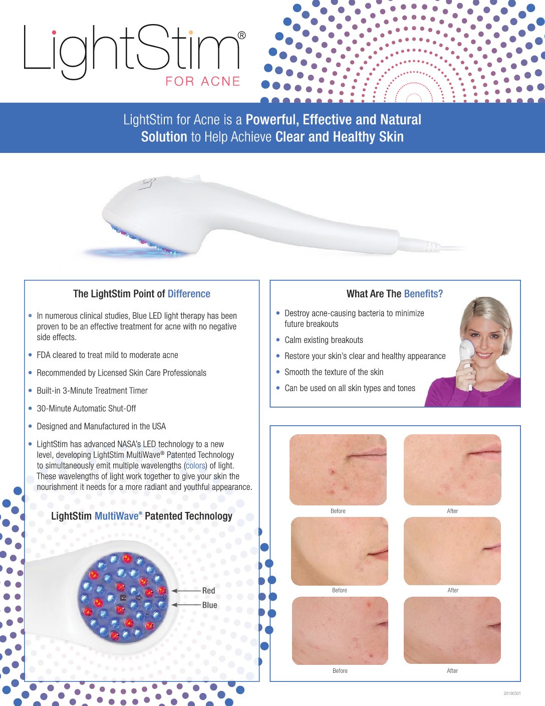 Lightstim for acne