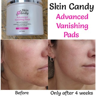 *Skin Candy Advanced Vanishing Pads - 4% Hydroquinone