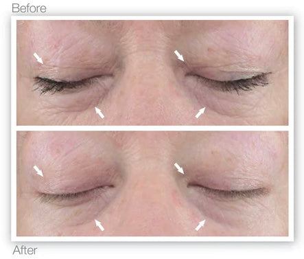 *Skin Candy No Needle Serum